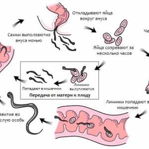 Честото инфекция (глисти) острици (enterobiasis) мъж