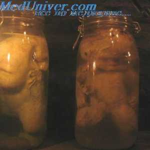 Образуване на ембриона изправена. Външните полови органи на фетуса