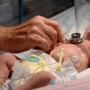 Хемолитична заболяване на новородени, лечение, причините