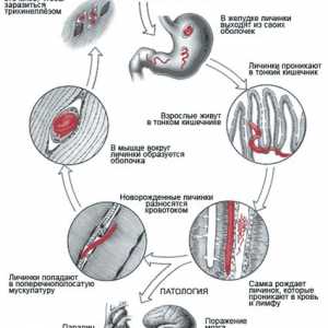 Хелминти (червеи), които живеят в човешките мускули, симптоми и снимки