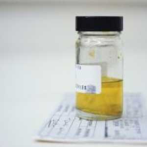 Изследването на урината, анализ на урина