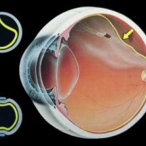 Ембриогенезата ретината