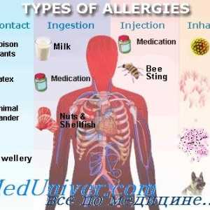 Епидемиология (разпространението) алергични заболявания атопия