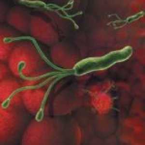 Какво бактерии причинява стомашни язви? Helicobacter Pylori, причинител на пептична язва