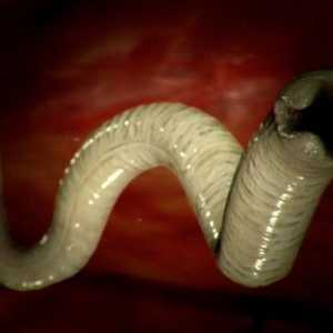 Какви са размерите на червеи (хелминти) в хората?