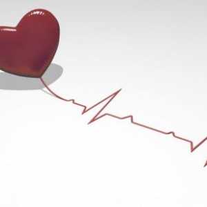 Сърдечно сърцето, лечение, симптоми и причини