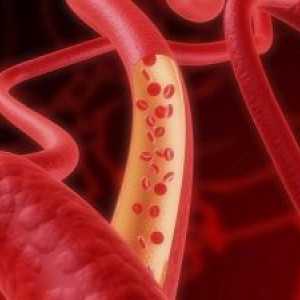 Кървене, причинено от увреждане на кръвоносните съдове