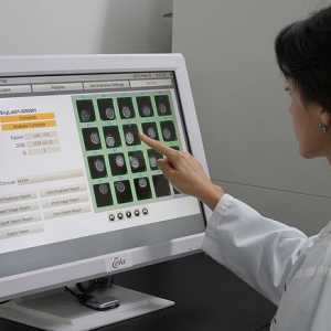 Лечение на стерилитет в Испания с eeva технология