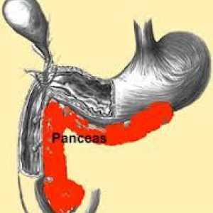 Лечение на панкреатит (панкреаса) в острия стадий