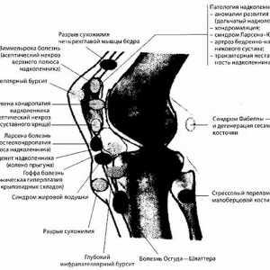 Радиационна и инструментална диагностика на колянната става патология