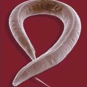Малки, дълги бели червеи в възрастен и дете