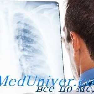 Механизми на астма. патогенеза