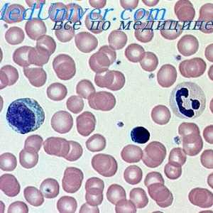 Унищожаването на хемоглобин. разнообразие от анемия