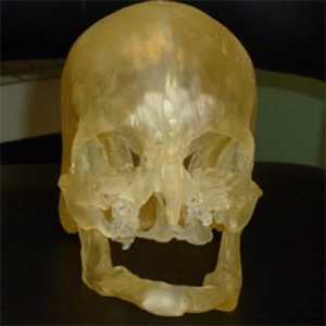 Моделът за лицето трансплантация може да бъде отпечатан на 3D-принтер