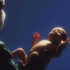 Не-инфекциозни заболявания на кожата, подкожната тъкан, пъпната и пъпна рана баланс при новородени