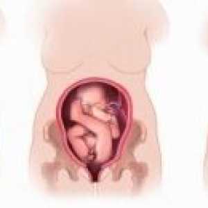 Грешна позиция и представяне на плода по време на бременност