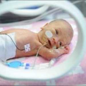 Нервната и неврологично възстановяване на недоносени бебета