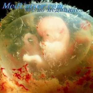 Образование устни и анален отвори ембрион. ембриона гърло