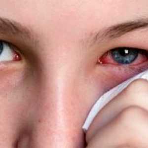 Ophthalmoherpes: лечение, симптоми