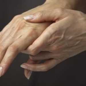 Запушване на горните крайници (ръцете, пръстите): Лечение, Причини, симптоми