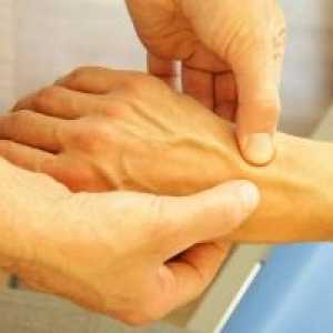 Остеоартритът на китката: за лекуване, причини, симптоми, признаци