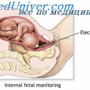Четата и раждането на плацентата. Болката по време на раждане