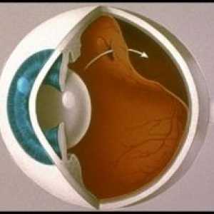 Отлепване на ретината на очите: причини, симптоми, лечение, симптоми