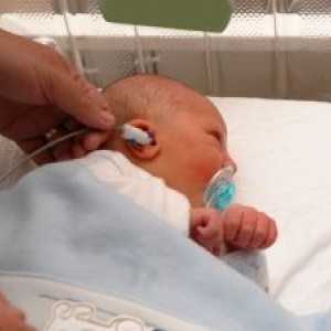 Перивентрикуларните левкомалация при преждевременно родени бебета