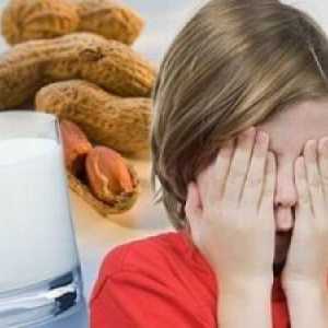 Хранителните алергии при децата на възраст над 7 години