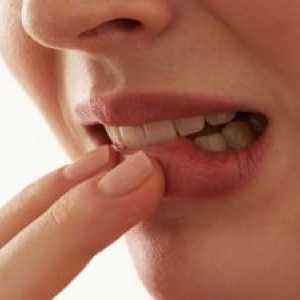 Плоскоклетъчен карцином на устната кухина: лечение, симптоми, прогноза