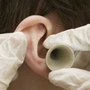 Победете ухото: при получаване на лекарства с херпес зостер
