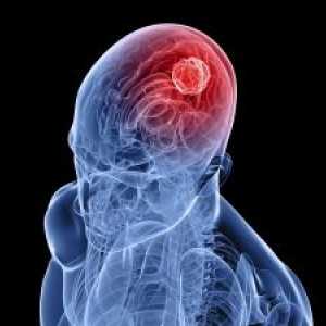 Лезиите на визуален път в тумори на мозъчните полукълба