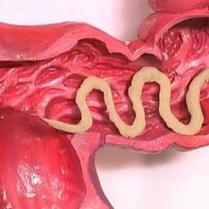 Повишен апетит с червеи (хелминти)
