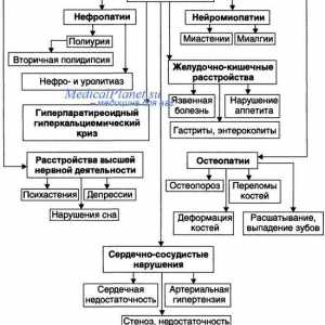 Хиперпаратиреоидизмът и остеодистрофия paratirioidnaya. Фиброцистозни остеит и болестта на фон…