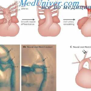 Развитие на артериалната съдова система. Етапи образуване на зародишен аорта