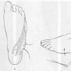 Белег деформация на стъпалото и глезена. Лечение дефекти повърхността на ходилото на крака