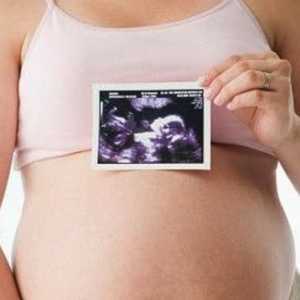 Широки таза на бременни жени