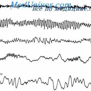 Мозъчните вълни и нива на активност на мозъка. Електроенцефалограм (ЕЕГ) сън