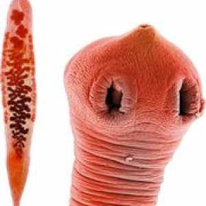 Симптоми червеи (хелминти) и жлъчните канали