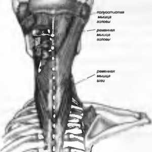 Болки в гърба, причинени от мускулна колан