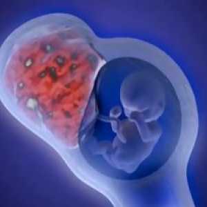 Образуване на утробата-плацентарната циркулация