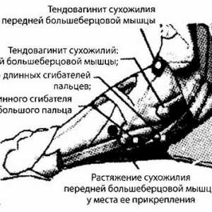 Foot, глезена и долната трета на радиация на тибията и диагностика инструмент