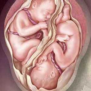 Бременност с близнаци снимка