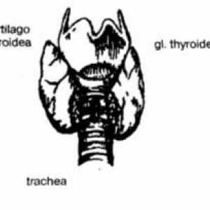 Трахеостомия