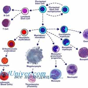 Трансплантация на стволови клетки в миелопролиферативни заболявания mieloleykoze