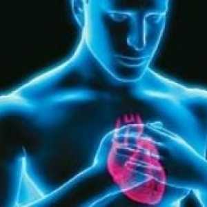Кокаин-индуцирана инфаркт на миокарда