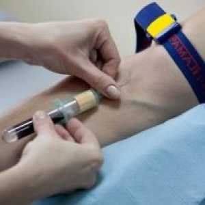 Кръвни проби от вени: алгоритъм, правила, оборудване венозна кръв за вземане на проби
