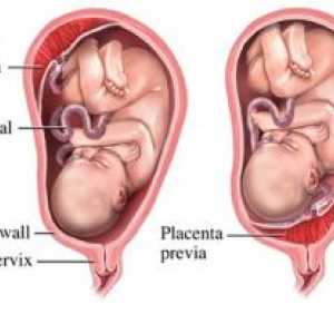 Забавянето в матката и плацентата на съставните му части